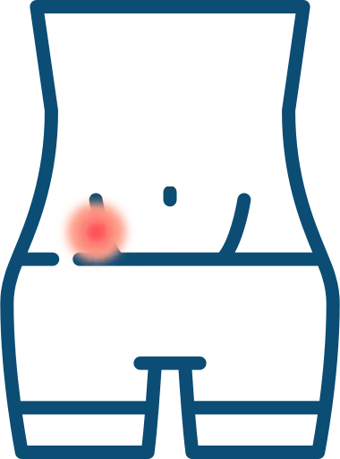 Apendicitis Apendicitis